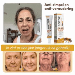 Anti-Wrinkle™ | Botox Wrinkle Removal Cream