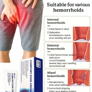 Newyuo™ Hemorrhoid Cream – Fast Relief from Pain, Itching & Swelling image Newyuo™ Hemorrhoid Cream – Fast Relief from Pain, Itching & Swelling