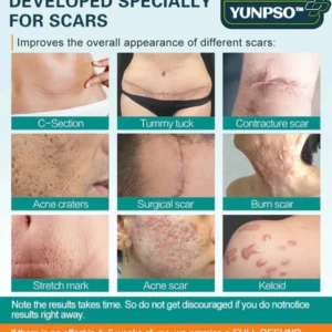 YUNPSO™ Advanced Scar Spray