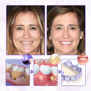 LAOZIK™ Bee Poison Advanced Gum Healing Toothpaste 12 LAOZIK™ Bee Poison Advanced Gum Healing Toothpaste