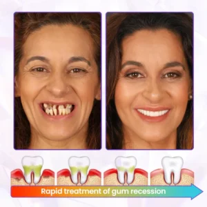 LAOZIK™ Bee Poison Advanced Gum Healing Toothpaste 11 LAOZIK™ Bee Poison Advanced Gum Healing Toothpaste