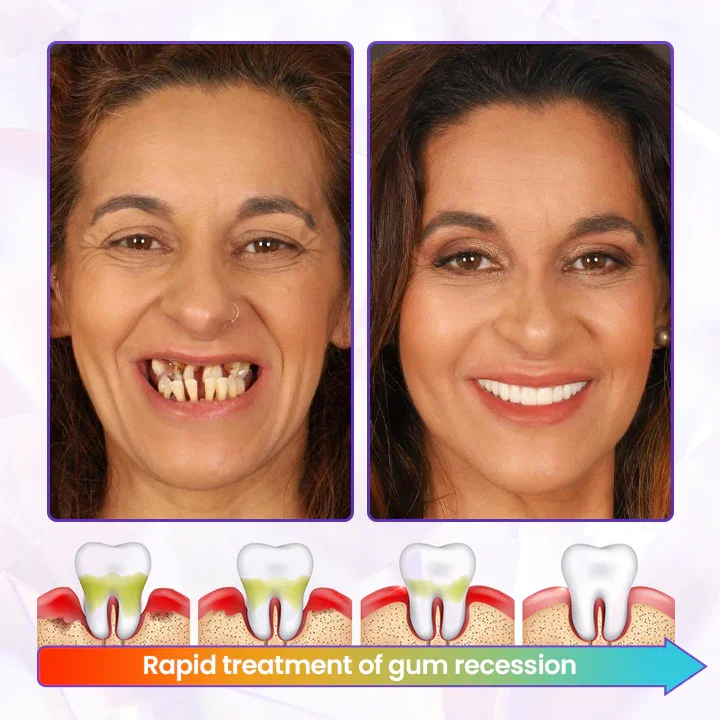 LAOZIK™ Bee Poison Advanced Gum Healing Toothpaste 2 LAOZIK™ Bee Poison Advanced Gum Healing Toothpaste
