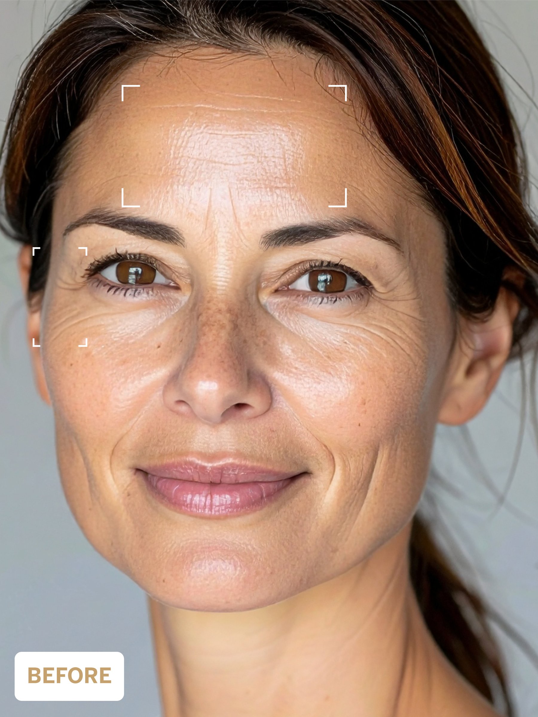 Crystal Osmoter™ X6 Serum 2 Crystal Osmoter™ X6 Serum