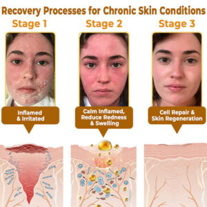 BeeRx™ Bee Venom Skin Restoration Cream 11 BeeRx™ Cream