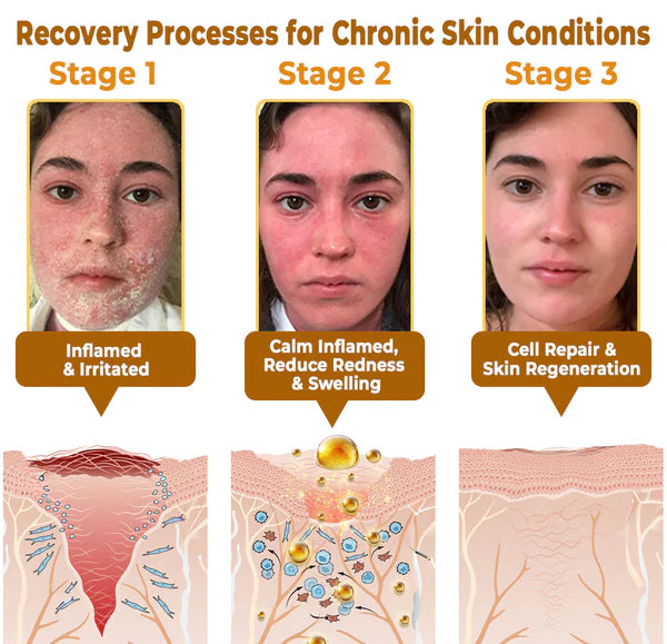 BeeRx™ Bee Venom Skin Restoration Cream 5 BeeRx™ Cream