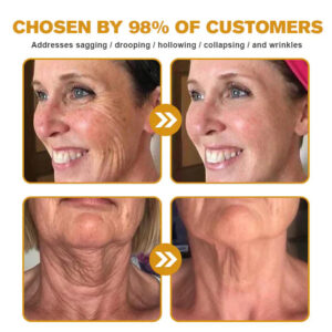 BeeRx™ Bee Venom Skin Restoration Cream 12 BeeRx™ Cream