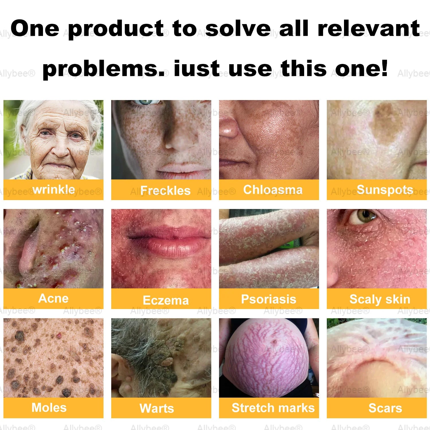 BeeRx™ Bee Venom Skin Restoration Cream 4 BeeRx™ Cream