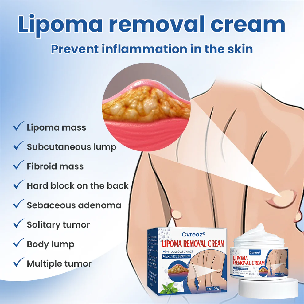 Cvreoz® Lipoma Removal Cream image Cvreoz® Lipoma Removal Cream