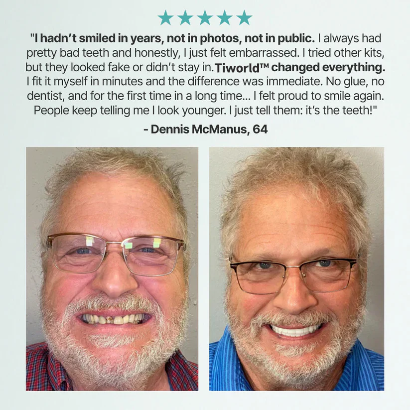 Tiworld™ Custom-Fit Full Functional Dentures 9 Tiworld™ Custom-Fit Full Functional DenturesTiworld™ Custom-Fit Full Functional Dentures