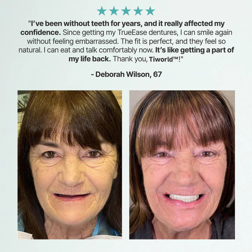 Tiworld™ Custom-Fit Full Functional Dentures 2 Tiworld™ Custom-Fit Full Functional Dentures
