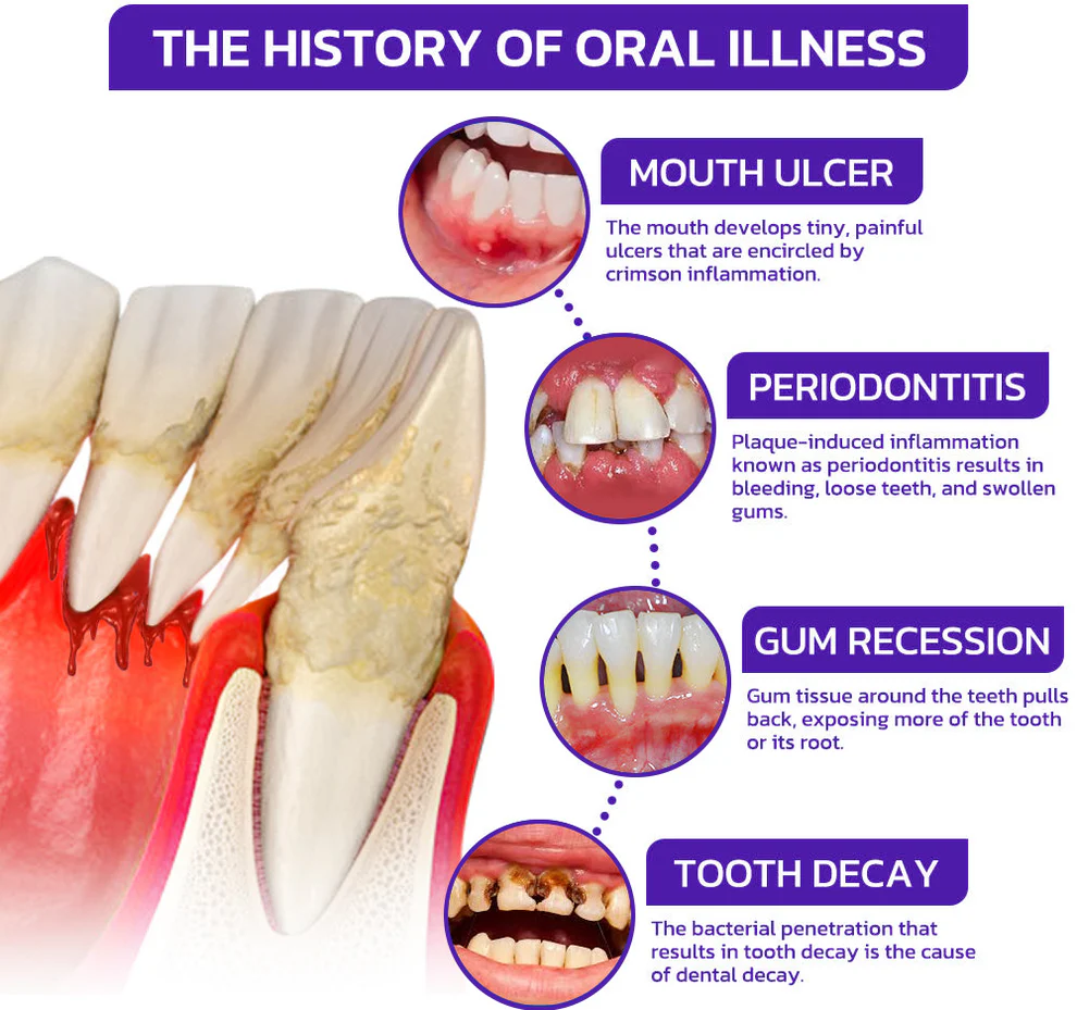 Rolimey® VioCore Bee Venom Dental Gum Therapy Toothpaste