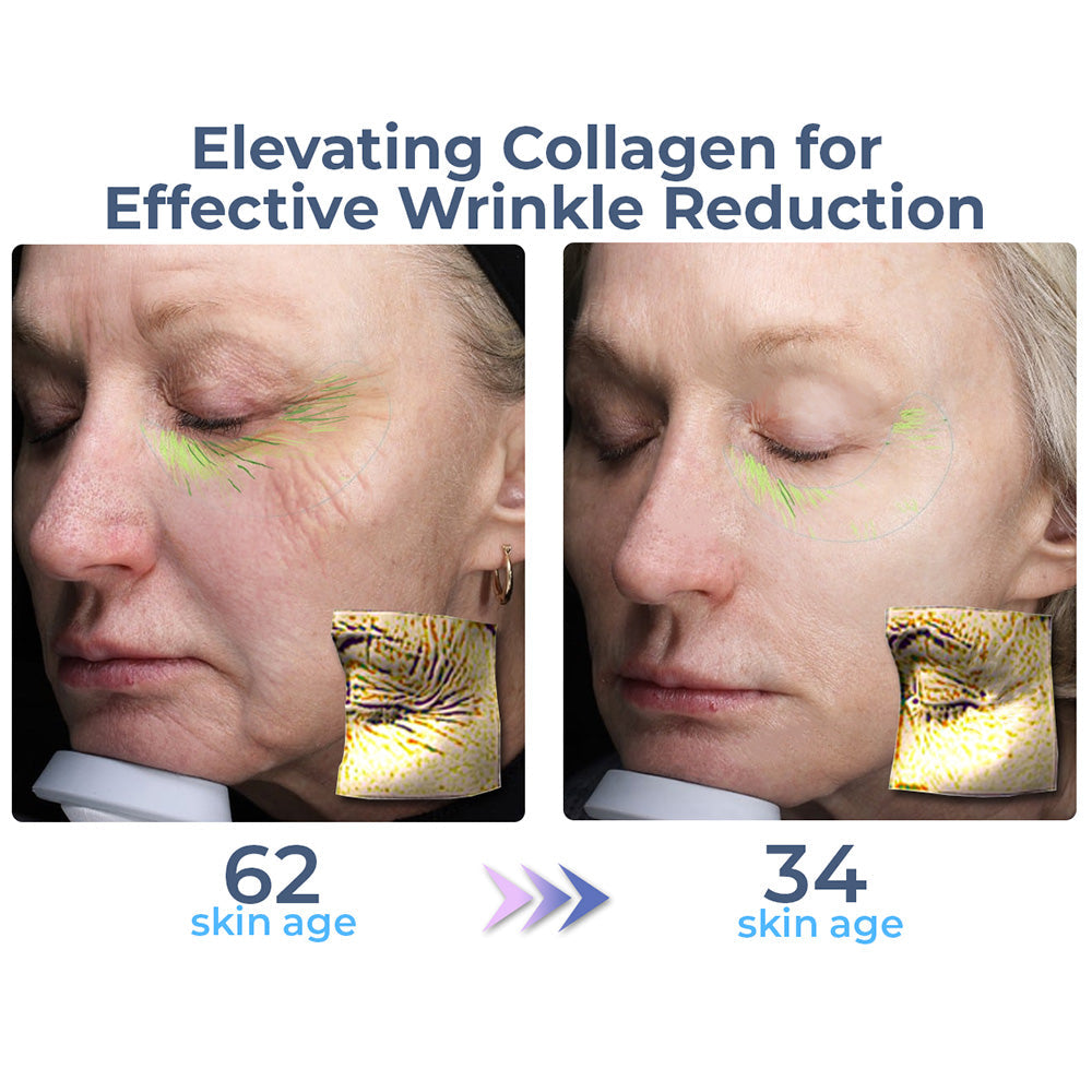 Advanced eye cream with complete collagen 3 Advanced eye cream with complete collagen
