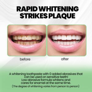 Hydroxyapatite Toothpastes 10% image Hydroxyapatite Toothpastes 10%