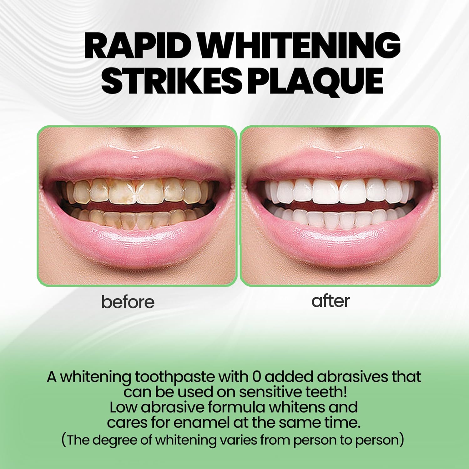 Hydroxyapatite Toothpastes 10% image Hydroxyapatite Toothpastes 10%