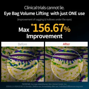 Eye bag cream image Eye bag cream