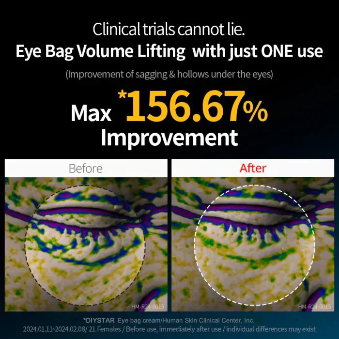 Eye bag cream image Eye bag cream