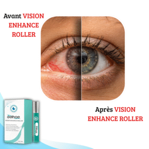 VISION ENHANCE ROLLER: Clarity - Give Your Eyes New Vitality