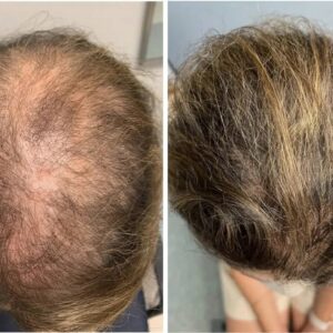 Boost hair growth naturally with Elycura image Boost hair growth naturally with Elycura