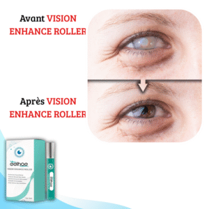 VISION ENHANCE ROLLER: Clarity - Give Your Eyes New Vitality