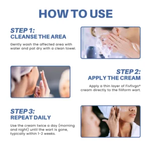 Fivfivgo® HPV Facial Filiform Warts Removal Cream