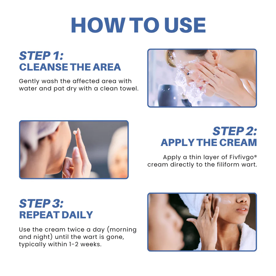 Fivfivgo® HPV Facial Filiform Warts Removal Cream