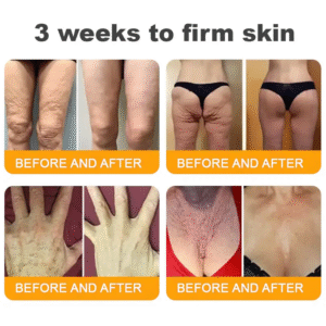 LOVILDS™ Bee Venom Skin Restoration Cream