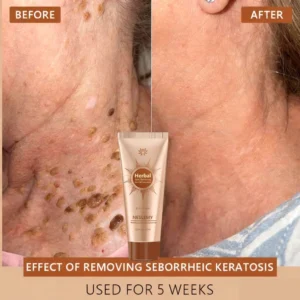 Removing Face Mask Suitable for face and body image Removing Face Mask Suitable for face and body