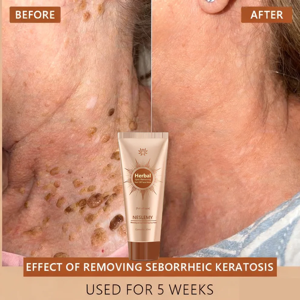 Removing Face Mask Suitable for face and body image Removing Face Mask Suitable for face and body