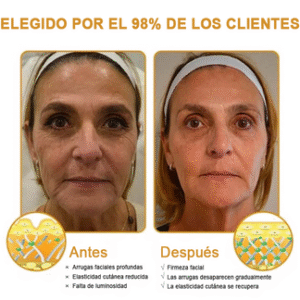 𝐅𝐮𝐫𝐳𝐞𝐫𝐨™ Botox Anti-Wrinkle Cream with Bee Venom