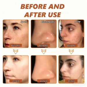 Removing Face Mask Suitable for face and body image Removing Face Mask Suitable for face and body