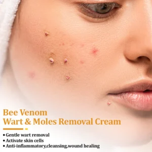 Fivfivgo™ TagCure Bee Venom Wart & Moles Removal Cream