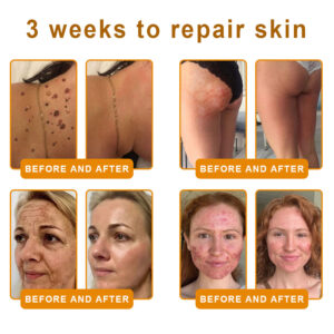 LOVILDS™ Bee Venom Skin Restoration Cream