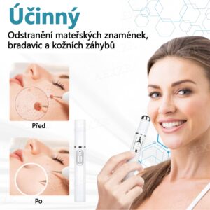 Foulme® PRO Non-invasive laser pen for wart and mole removal