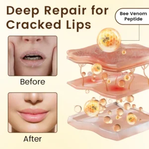 Ceoerty® BeeLixir Lip Repair Balm image Ceoerty® BeeLixir Lip Repair Balm