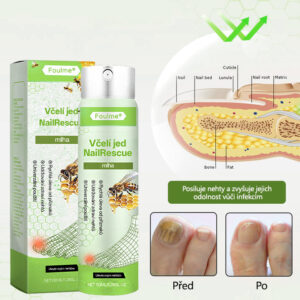 Foulme® NailRescue Bee Venom Spray