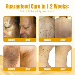 Fivfivgo™ Bee Venom Multi-Skin Treatment Spray image Fivfivgo™ Bee Venom Multi-Skin Treatment Spray