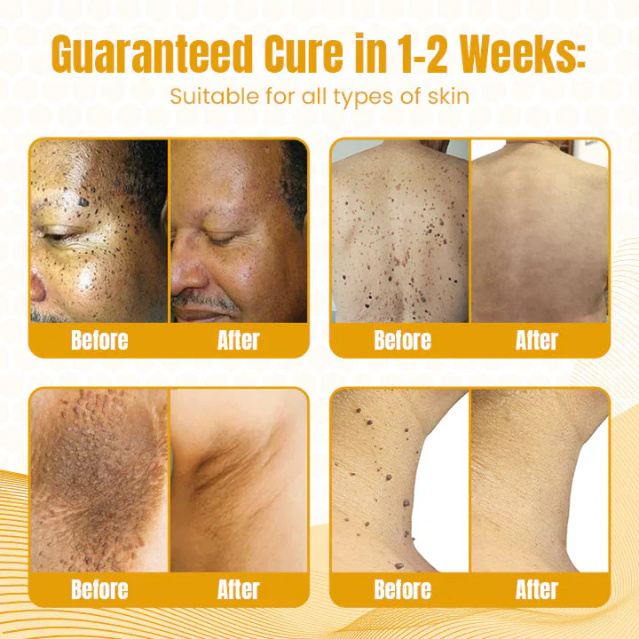 Fivfivgo™ Bee Venom Multi-Skin Treatment Spray image Fivfivgo™ Bee Venom Multi-Skin Treatment Spray