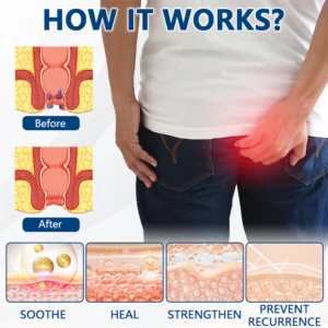 SKAVIX™ Herbal Spray