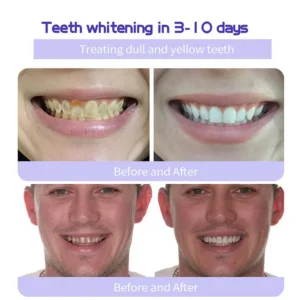 BQYOOM™ Teeth Restorative Mineral Powder