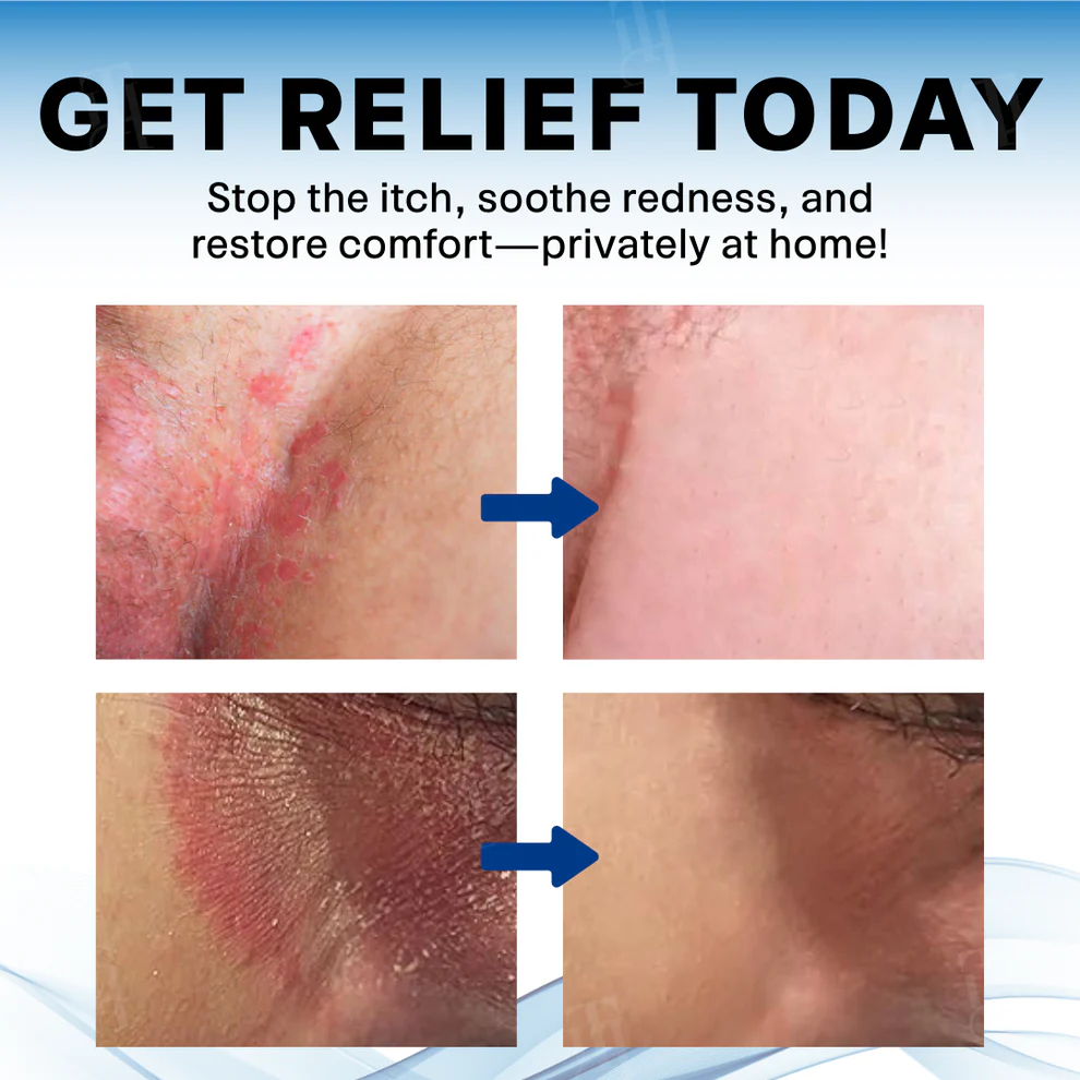 Fivfivgo® Scrotum Itchy Treatment Cream image Fivfivgo® Scrotum Itchy Treatment Cream