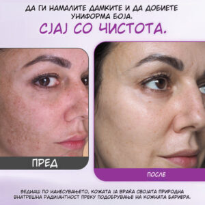 MelantraX – Advanced essence against pigmentation spots image MelantraX – Advanced essence against pigmentation spots