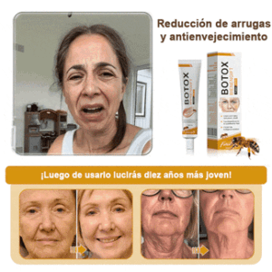𝐅𝐮𝐫𝐳𝐞𝐫𝐨™ Botox Anti-Wrinkle Cream with Bee Venom