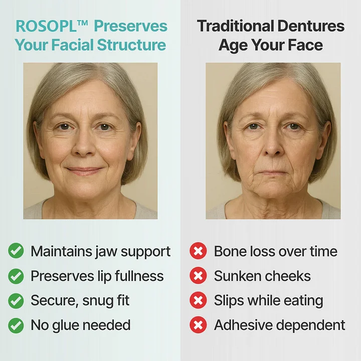 ROSOPLTM Custom Dentures image ROSOPLTM Custom Dentures