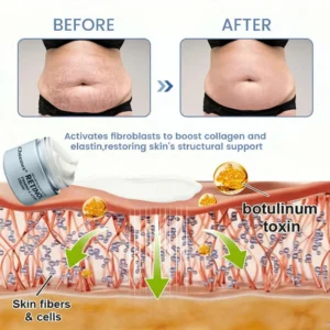 Cheemex® Advanced Botulinum Toxin Peptide Retinol Firming & Lifting Cream
