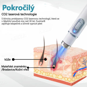 Foulme® PRO Non-invasive laser pen for wart and mole removal