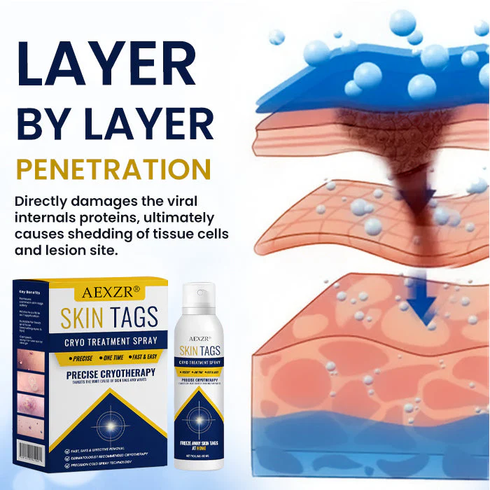 AEXZR® Skin Tag Cryo Treatment Spray image AEXZR® Skin Tag Cryo Treatment Spray
