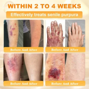 Cheemex® Bee Venom Skin Restoration Cream