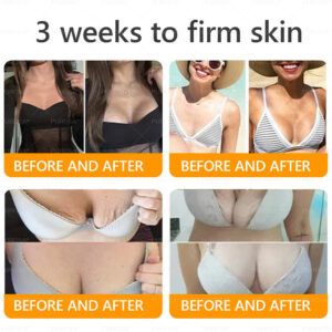 LOVILDS™ Bee Venom Skin Restoration Cream