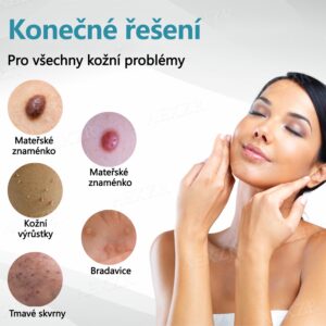 Foulme® PRO Non-invasive laser pen for wart and mole removal