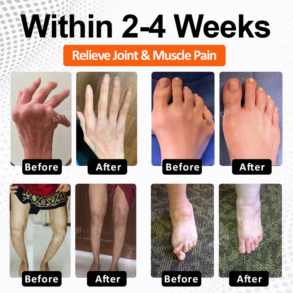 ATTDX® Mobility Max Magnesium Complex Softgels image ATTDX® Mobility Max Magnesium Complex Softgels